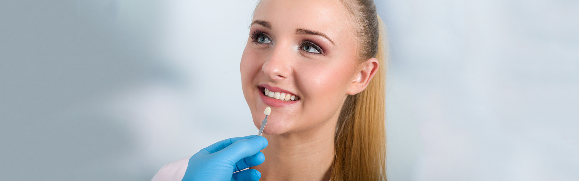 Veneers